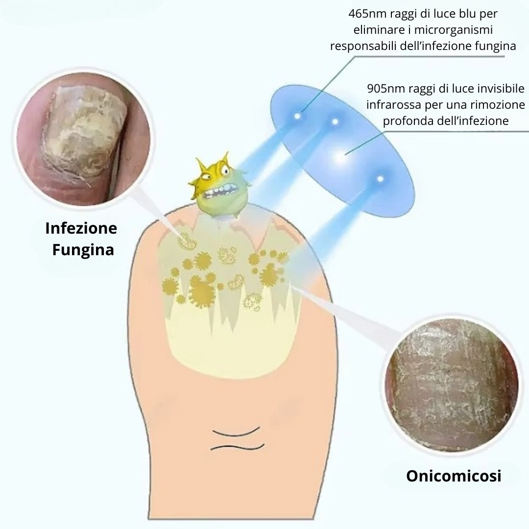 Cenessa - Fungilux™